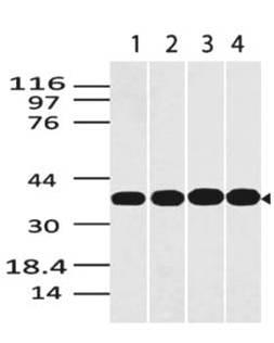 Monoclonal Antibody to GAPDH (Clone: ABM22C5)