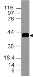 Monoclonal Antibody to Dc-Sign/CD 209 (Clone: ABM47B7)