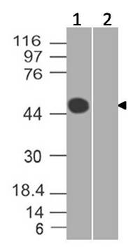 Monoclonal Antibody to SARS-CoV-2 nucleocapsid (Clone: ABM3A11.1B5)