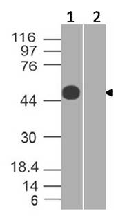 Monoclonal Antibody to SARS-CoV-2 nucleocapsid (Clone: ABM5H9.1A2)