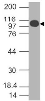 SARS CoV2 Spike S1 Antibody (Clone: ABM1G2.1F7)