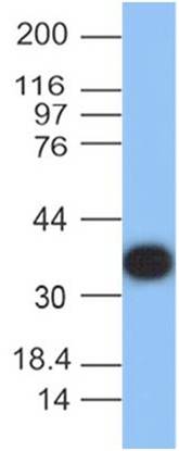 Protein A Monoclonal Antibody (Clone: ABM4B3.1G3)