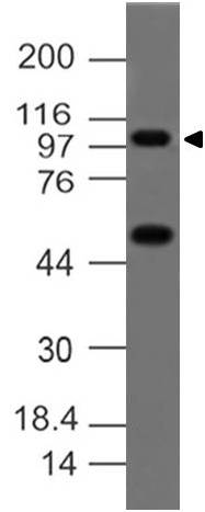 Monoclonal antibody to A-20/TNFAIP3 (Clone: ABM1G20 )