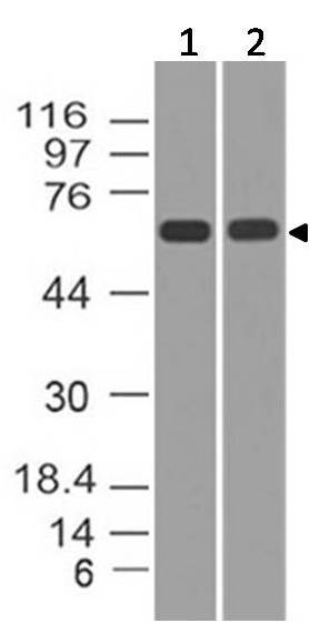 Monoclonal Antibody to p73 (Clone: ABM1G28)