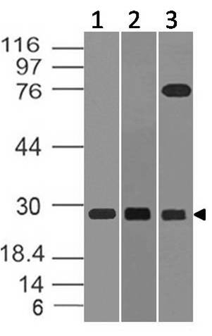 Monoclonal Antibody to TRAIL (Clone: ABM1B29)