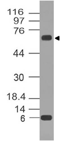 Monoclonal Antibody to p73 (Clone: ABM13D1)