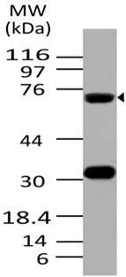 Monoclonal Antibody to ATF6 (Clone: ABM1A40)