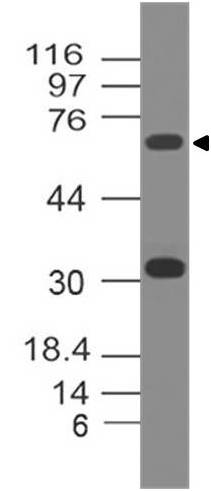 Monoclonal Antibody to p73  (Clone: ABM15G3)