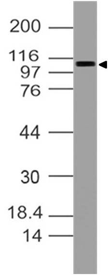 Monoclonal antibody to RB1 (Clone: ABM17H9 )