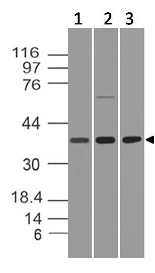 Monoclonal Antibody to HtrA2 (Clone: ABM1H83)