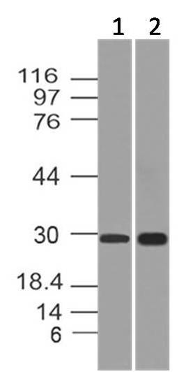 Monoclonal Antibody to APIP  (Clone: ABM19C7)