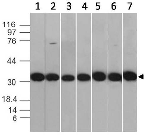 Monoclonal antibody to  Annexin V (Clone: ABM4D1.1G11)