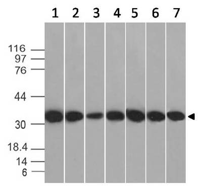 Monoclonal antibody to  Annexin V (Clone: ABM4C5.2B4)