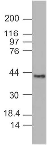 Monoclonal Antibody to PINK1 (Clone: ABM5D85)