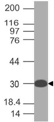 Monoclonal antibody to RLIP (Clone: ABM2G10.1B4)