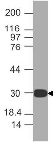 Monoclonal antibody to RLIP (Clone: ABM3G10.1E9)