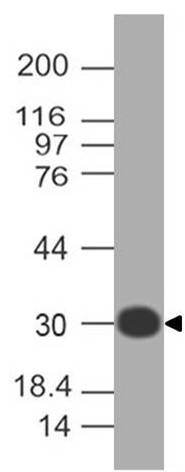 Monoclonal antibody to RLIP (Clone: ABM6D5.1E4)