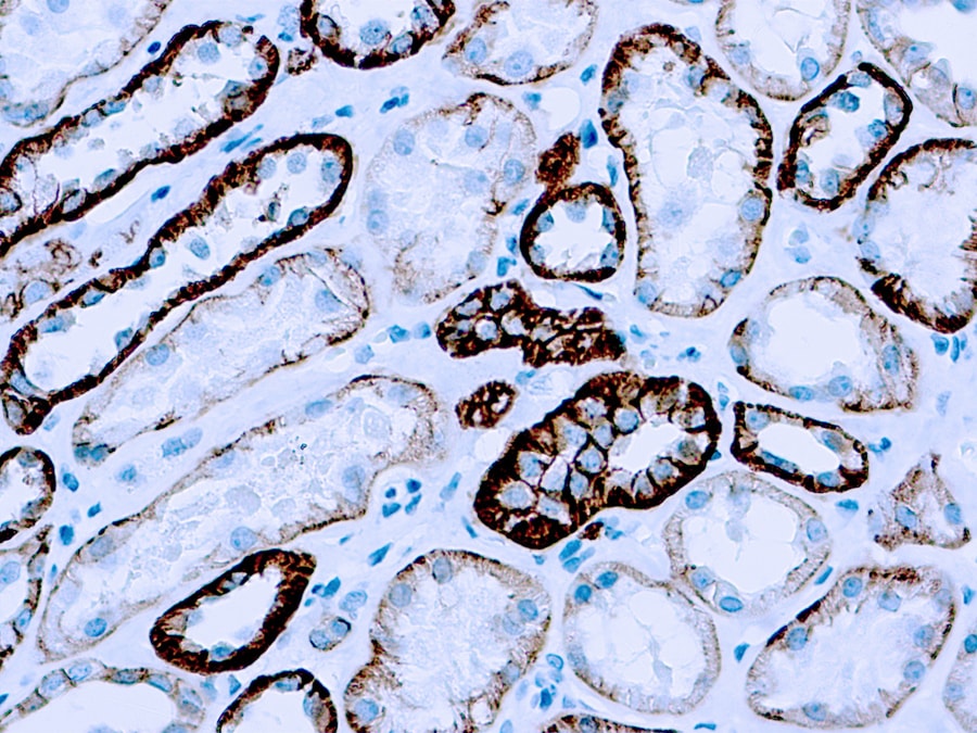 Mouse Monoclonal Antibody to Cadherin, Pan(Clone: CH-19)(Discontinued)