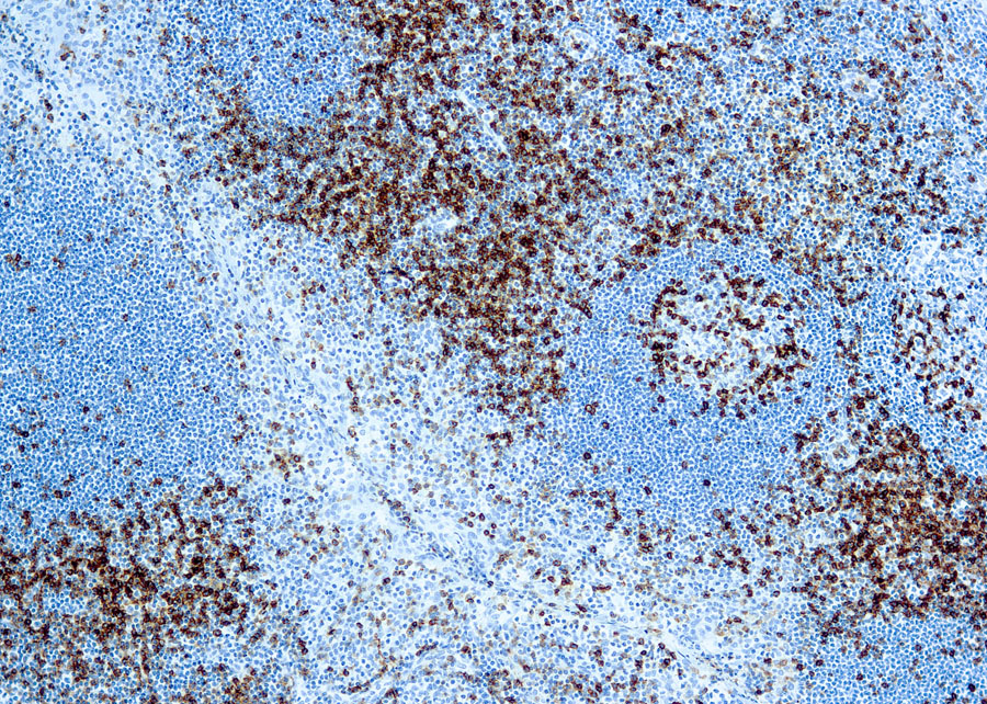 Mouse Monoclonal Antibody to CD45RO(Clone: UCHL-1)(Discontinued)