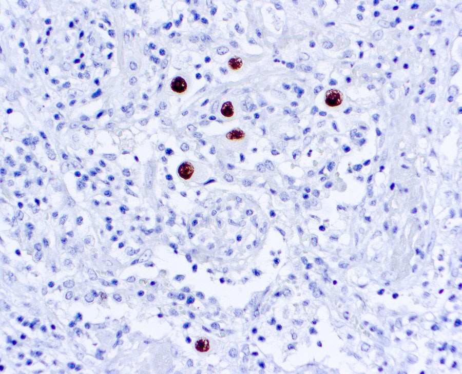 Mouse Monoclonal Antibody to Cytomegalovirus(Clone: DDG9 + CCH2)(Discontinued)