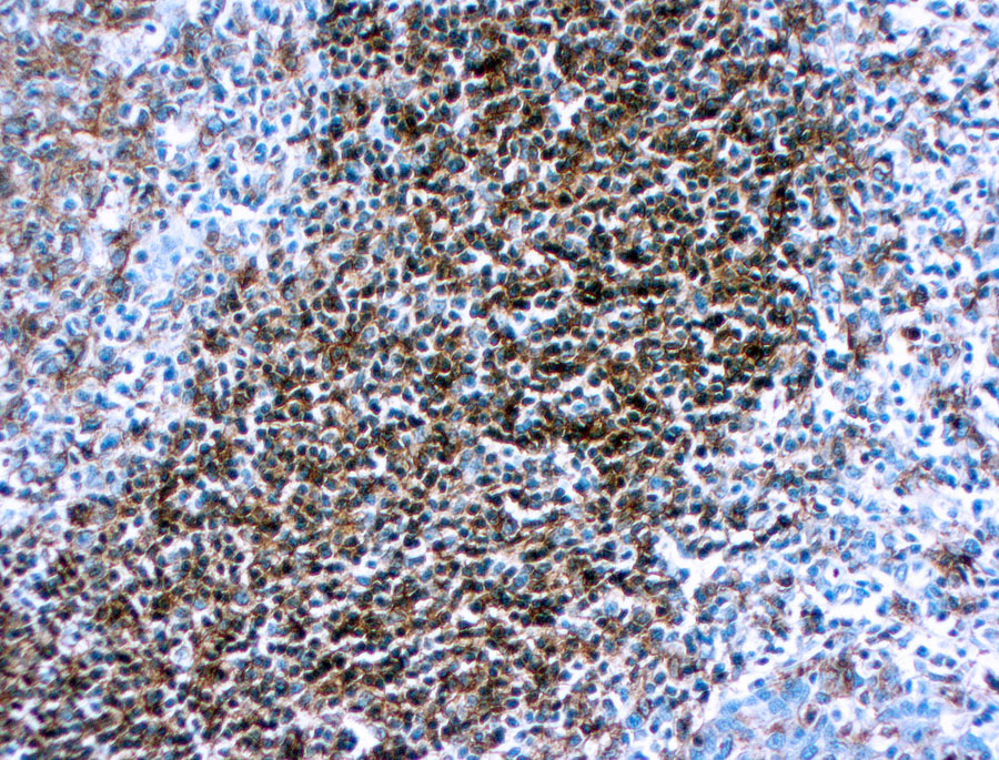 Mouse Monoclonal Antibody to HLA-DR, DP, DQ & DR(Clone: CR3/43)(Discontinued)