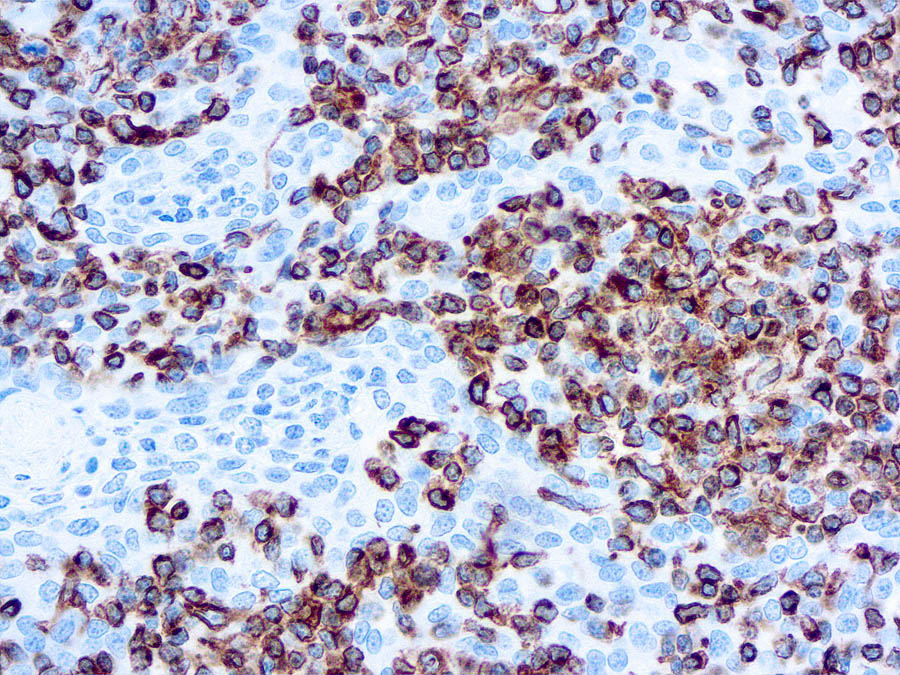 Mouse Monoclonal Antibody to Vimentin(Clone: V9)(Discontinued)