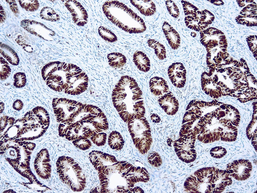 Mouse Monoclonal Antibody to p53(Clone: DO7)(Discontinued)