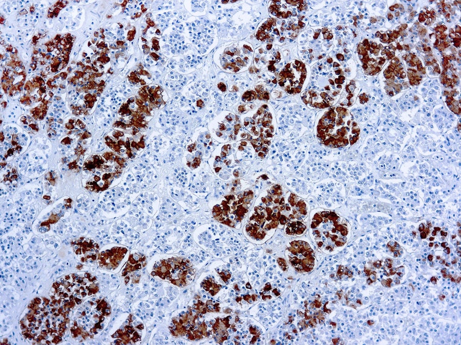 Mouse Monoclonal Antibody to ACTH(Clone: AH26)(Discontinued)