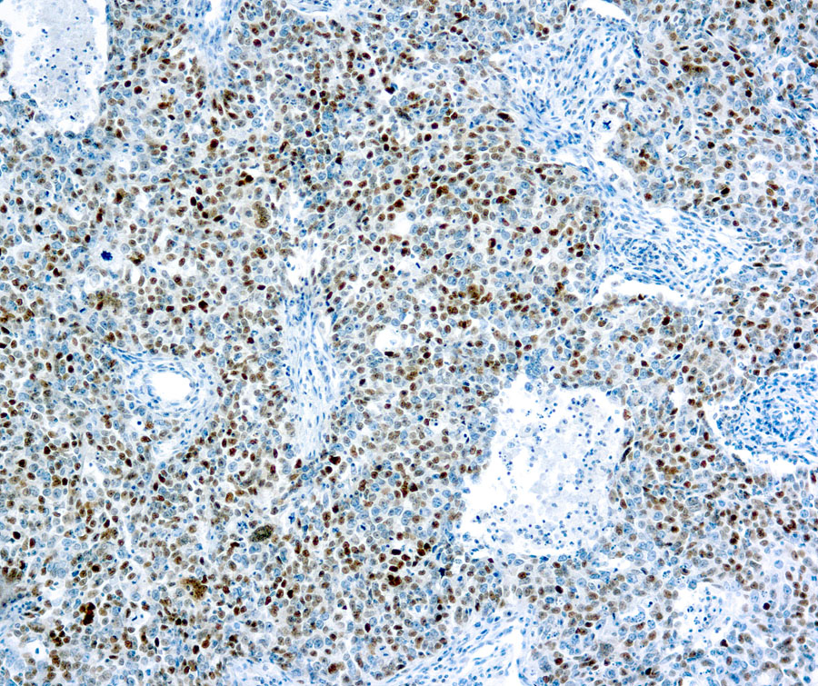 Mouse Monoclonal Antibody to Cyclin E(Clone: HE12)(Discontinued)