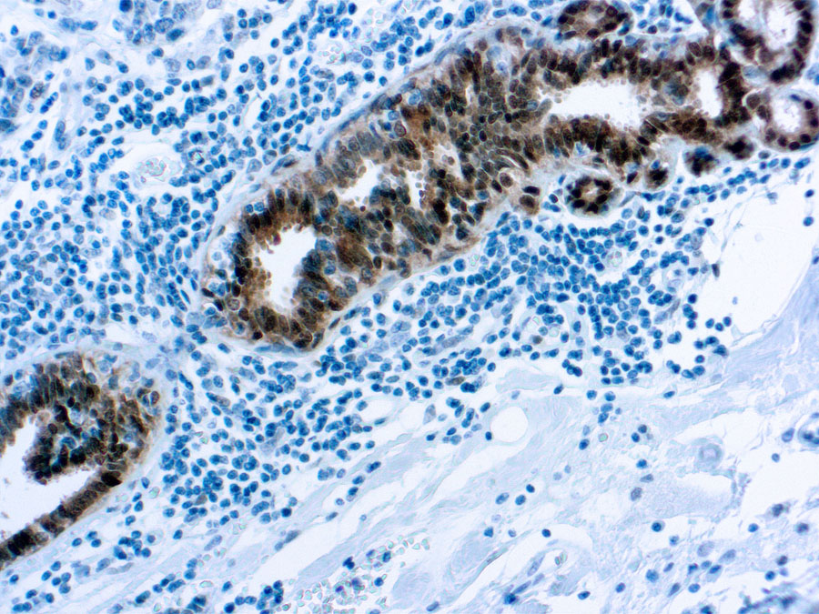 Mouse Monoclonal Antibody to Heat Shock Protein 70(Clone: W27)(Discontinued)