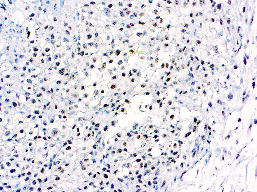 Mouse Monoclonal Antibody to MyoD1(Clone: 5.2f)(Discontinued)