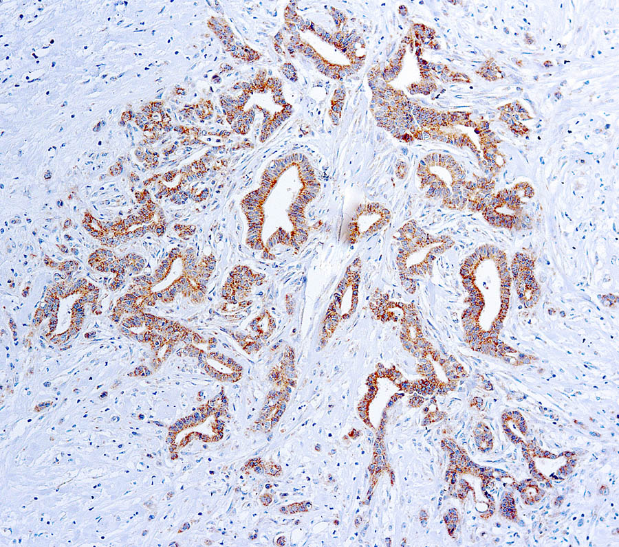 Mouse Monoclonal Antibody to VEGF(Clone: VG1)(Discontinued)