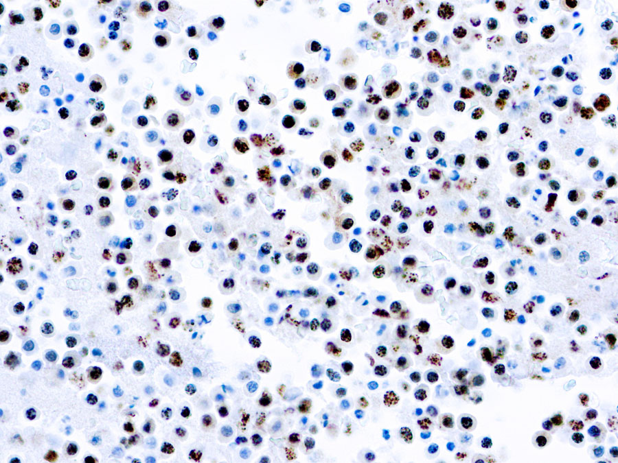 Rat Monoclonal Antibody to HHV8(Clone: LN53)(Discontinued)