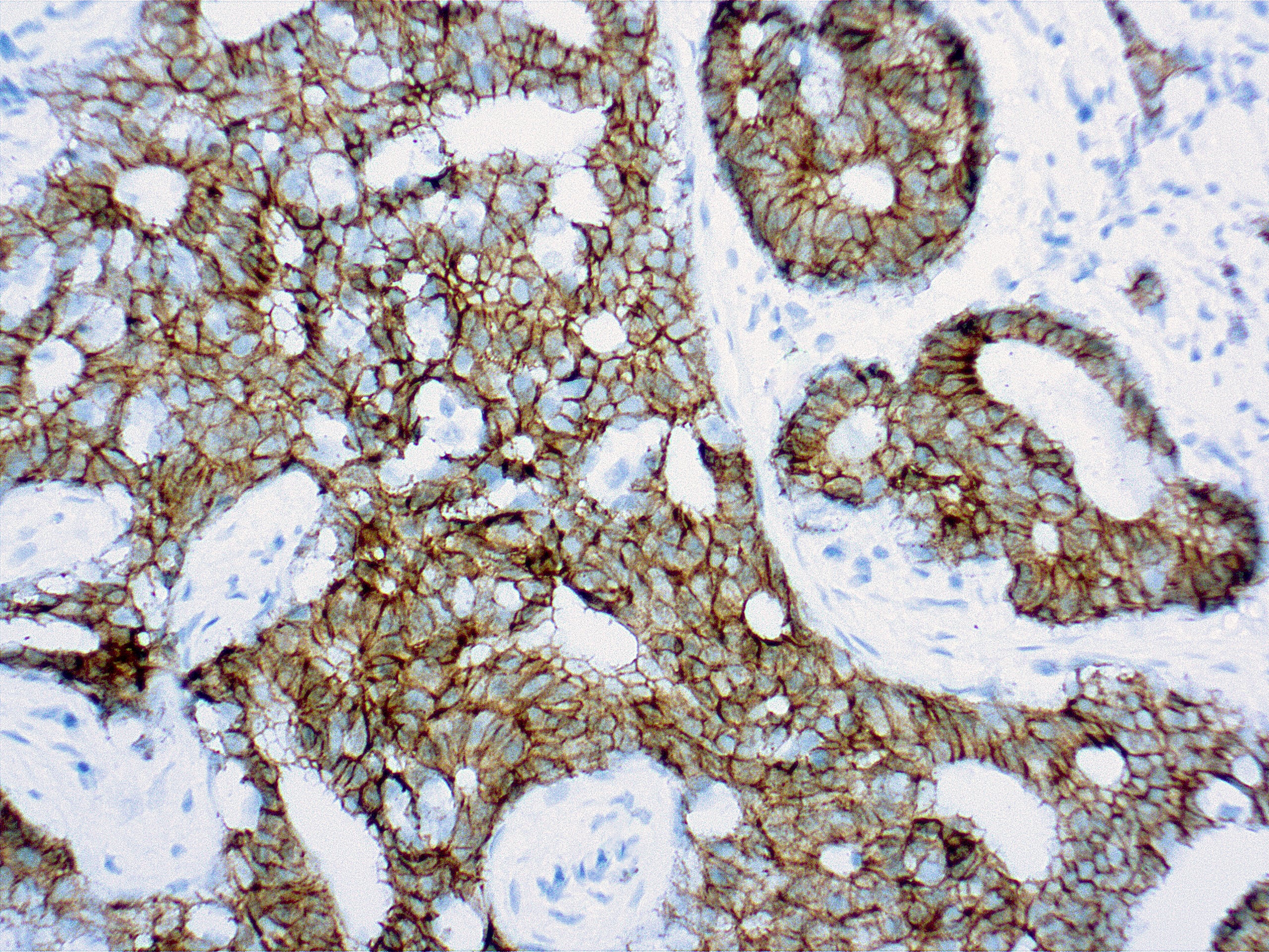 Mouse Monoclonal Antibody to  E-Cadherin(Clone : DBM15.49)(Discontinued)