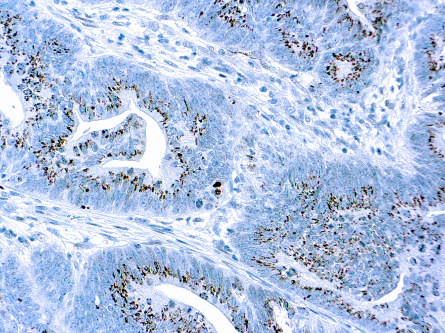 Rabbit Polyclonal Antibody to Caspase 3(Discontinued)