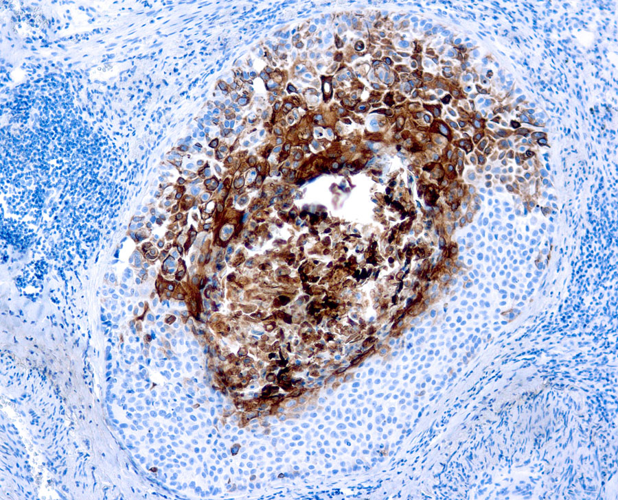 Mouse Monoclonal Antibody to Cytokeratin 17(Clone: E3)(Discontinued)