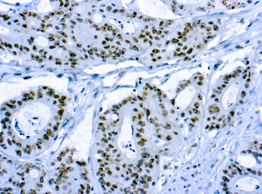 Mouse Monoclonal Antibody to CD56, NCAM-1(Clone: 123C3.D5)(Discontinued)