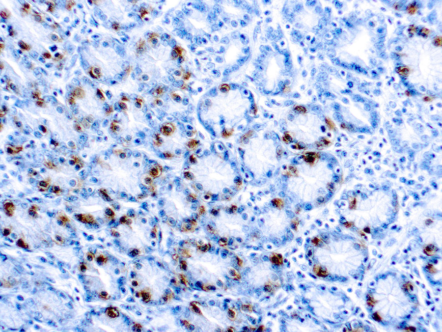 Rabbit Polyclonal Antibody to Gastrin(Discontinued)