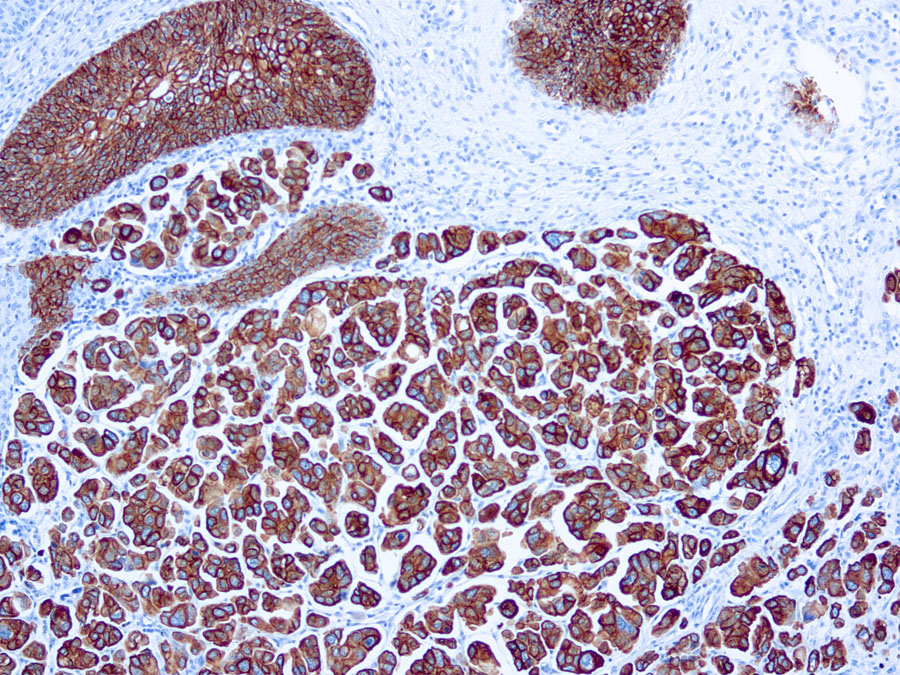 Mouse Monoclonal Antibody to Cytokeratin 7(Clone: OV-TL 12/3)(Discontinued)