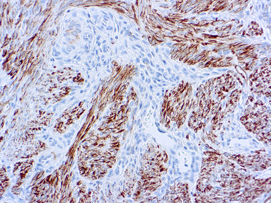 Mouse Monoclonal Antibody to Desmin(Clone: D33)(Discontinued)