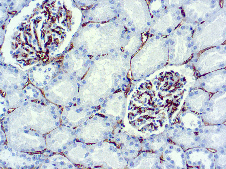 Mouse Monoclonal Antibody to CD34, Endothelial Cell(Clone: QBEND/10)(Discontinued)