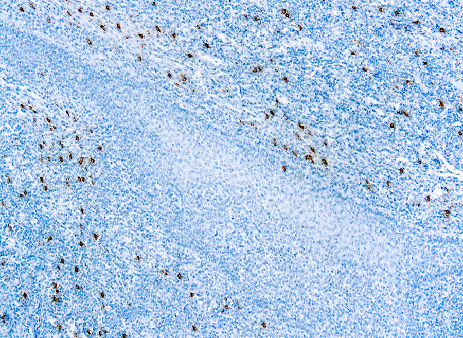 Mouse Monoclonal Antibody to Mast Cell Tryptase(Clone: AA1)(Discontinued)