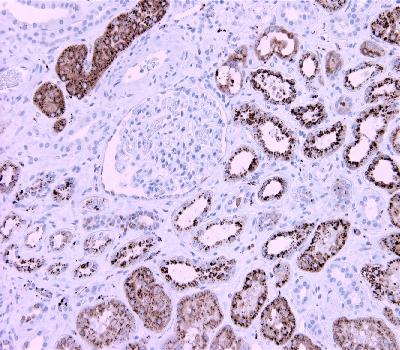 Mouse Monoclonal Antibody to Napsin A(Clone :BS10)