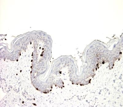 Mouse Monoclonal Antibody to Melan A(Clone :BS52)