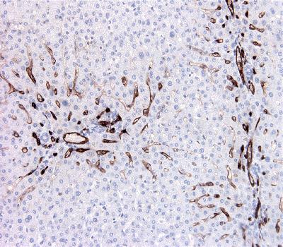 Mouse Monoclonal Antibody to CD34(Clone :BS72)