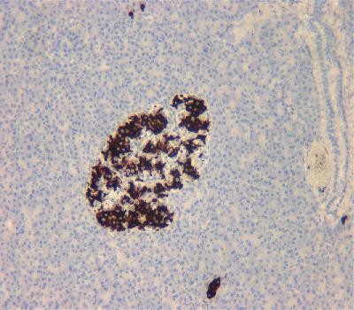 Mouse Monoclonal Antibody to Insulin (Clone :BS22)