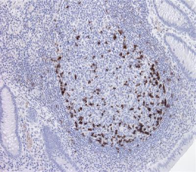 Rabbit Monoclonal Antibody to PD1(Clone :BSR1)(Discontinued)