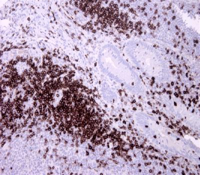 Rabbit Monoclonal Antibody to CD7(Clone :BSR9)