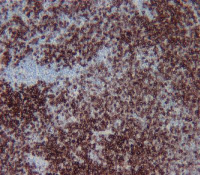 Mouse Monoclonal Antibody to CD23(Clone :BS20)