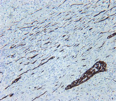 Rabbit Monoclonal Antibody to L1CAM(Clone :BSR3)